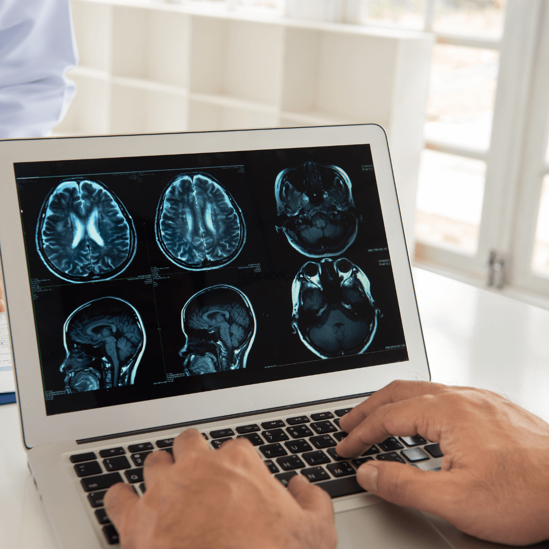 Estudo revela como o estresse crônico afeta o cérebro por meio do sistema imunológico